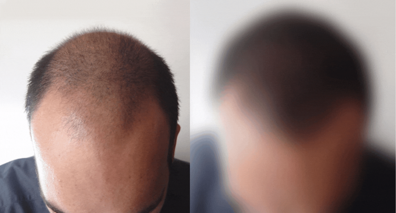 capelli recensione