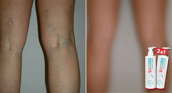 varigood crema recensione